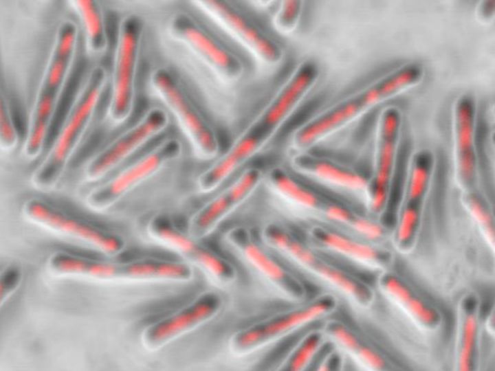 C. diff bacteria